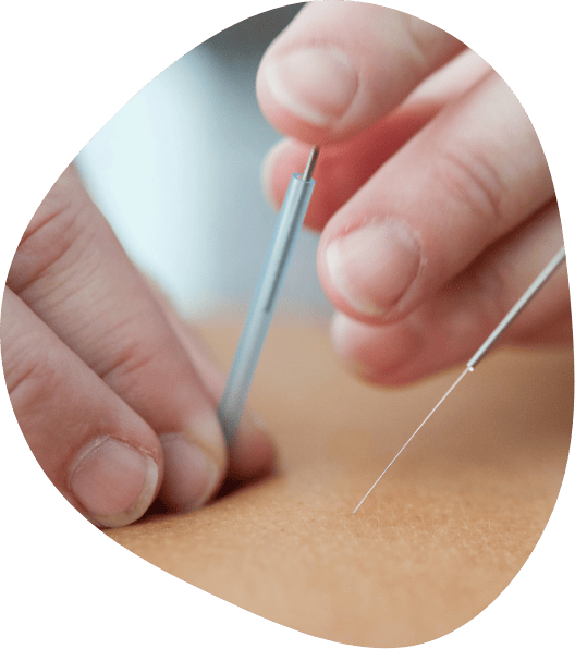 Acupuncture at The Better Life Place Rehab in Thailand.